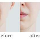 ほうれい線の原因と対策♪